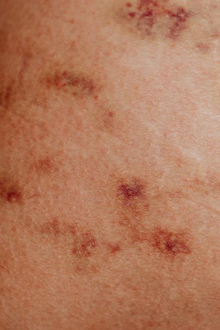 Infekcije kože: kada je crvenilo potrebno liječiti antibiotikom